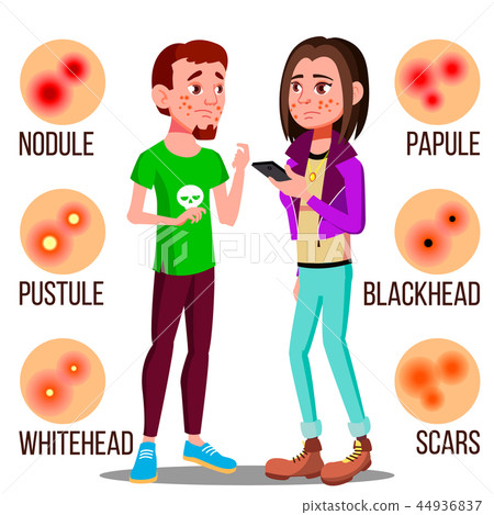 Upset Teenager With Pimples On The Face Vector. Isolated Illustration Upset Teenager With Pimples On The Face Vector. Isolated Illustration 44936837