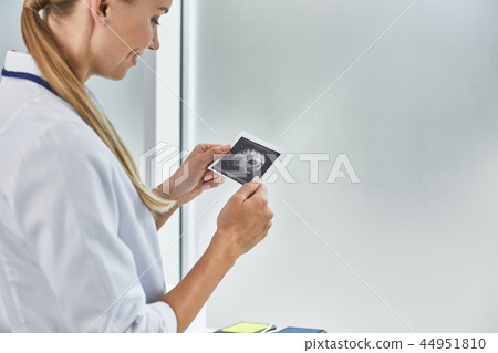 Young doctor looking at ultrasound picture of future baby 44951810