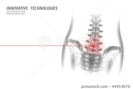 Human spine hip lumbar radiculitis pain low poly. Geometric polygonal particle triangle point line 44953679
