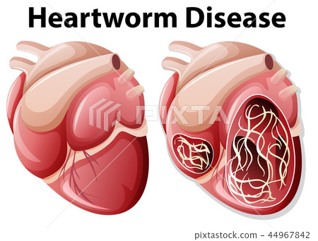 Heartworm disease diagram white background 44967842