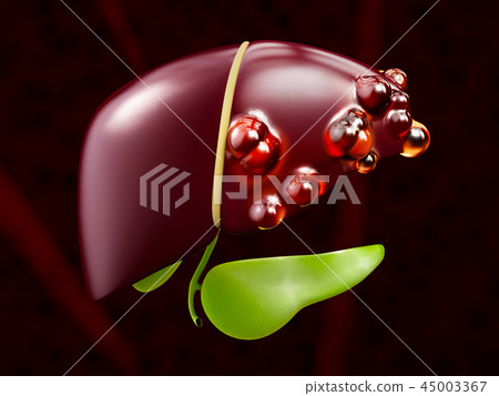 3d illustration of Abstract medical background with Diseased liver 3d illustration of Abstract medical background with Diseased liver 45003367