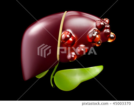 3d illustration of Diseased liver isolated black 3d illustration of Diseased liver isolated black 45003370
