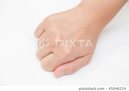 水泡 水泡 45046224