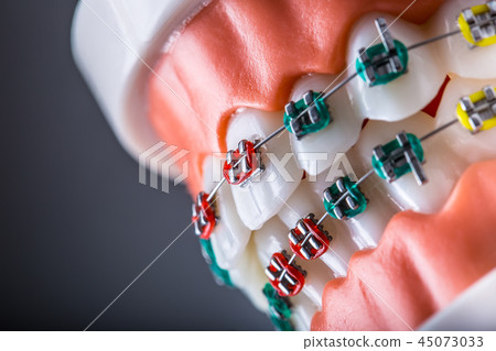 Orthodontic model jaws and teeth with braces. Orthodontic model jaws and teeth with braces. 45073033
