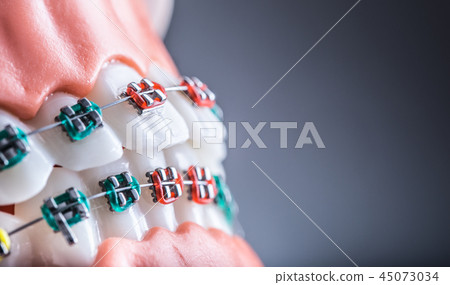 Orthodontic model jaws and teeth with braces. Orthodontic model jaws and teeth with braces. 45073034