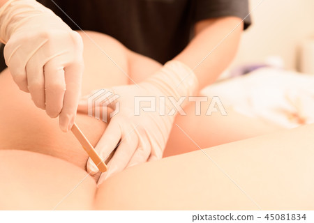 脫毛蠟去除脫毛區治療自然光圖像 45081834