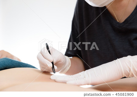 Hair removal Wax removal Hair removal zone Treatment Hair removal Image 45081900