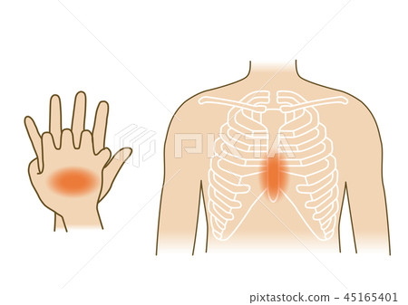 First aid illustration 74: Emergency resuscitation, chest compression 45165401
