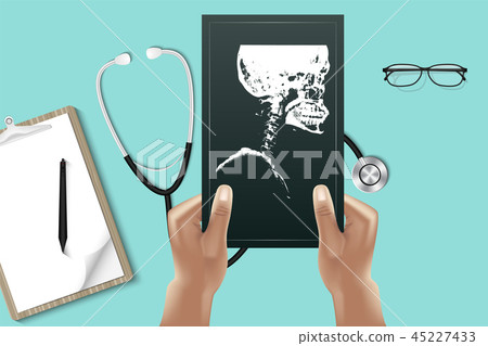 Close up doctor hands is holding X-Ray film Close up doctor hands is holding X-Ray film 45227433