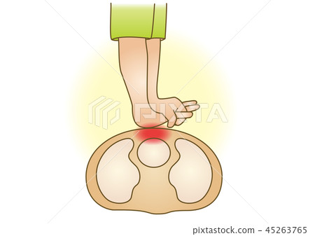 急救圖82：緊急復甦，胸部按壓 45263765