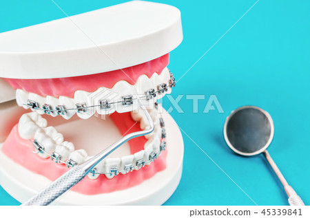 tooth model with metal wire dental braces. 45339841