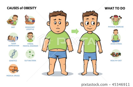 Obesity causes and prevention. Young guy before and after diet and fitness. Colorful infographic Obesity causes and prevention. Young guy before and after diet and fitness. Colorful infographic 45346911