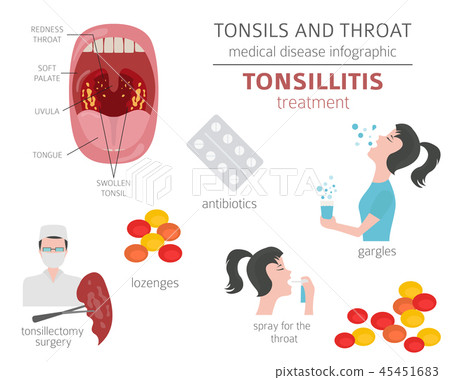 Tonsils and throat diseases. Tonsillitis Tonsils and throat diseases. Tonsillitis 45451683
