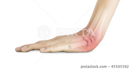 wrist bones injury wrist bones injury 45505592