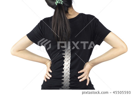 spine bones injury 45505593