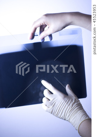 Xray breast scan mammogram 45523953
