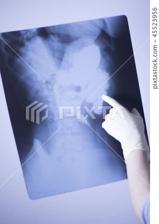 Medical xray spine hip scan Medical xray spine hip scan 45523956