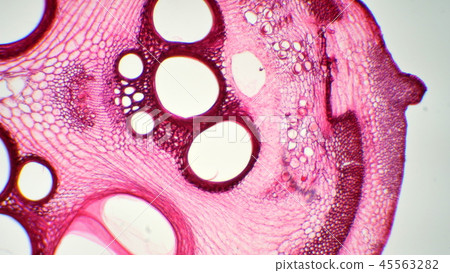 Photomicrograph of a cross-section of the stem of lima 45563282