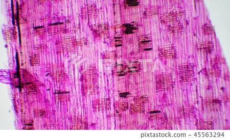 木材細胞 45563294