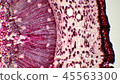 Photomicrograph of a cross section of a pine tree 45563300