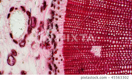 Photomicrograph of a cross section of a pine tree 45563302