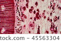 Photomicrograph of a cross section of a pine tree 45563304