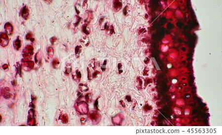 Photomicrograph of a cross section of a pine tree Photomicrograph of a cross section of a pine tree 45563305
