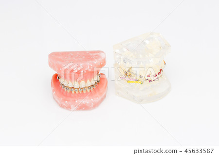 Human teeth orthodontic dental model, braces Human teeth orthodontic dental model, braces 45633587