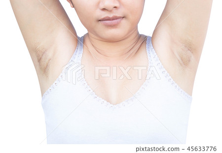 Women problem black armpit on white background Women problem black armpit on white background 45633776