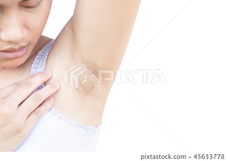 Women problem black armpit on white background  45633778