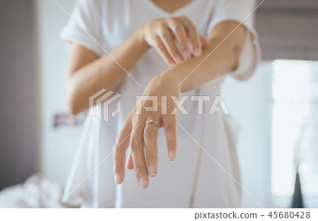 Woman with rash or papule and scratchon her arm Woman with rash or papule and scratchon her arm 45680428