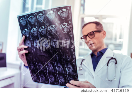 Close up of male hands that holding roentgen photo Close up of male hands that holding roentgen photo 45716529