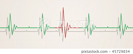 irregular heart beat 45729834
