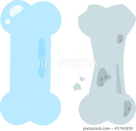 Fragile bones and healthy bones, osteoporosis 45743850