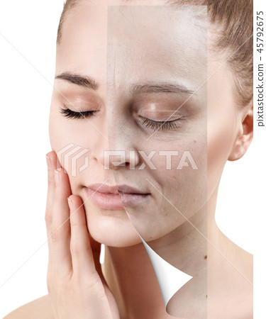 Portrait of woman before and after skin rejuvenation 45792675