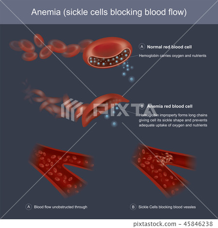 Hemoglobins improperly forms long chains Hemoglobins improperly forms long chains 45846238