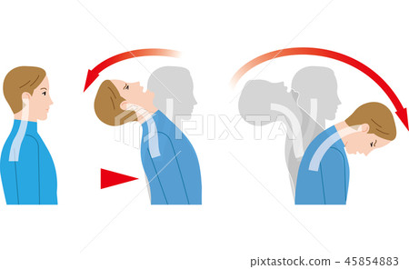 Movement of the neck by the impact from the back. Whiplash. 45854883