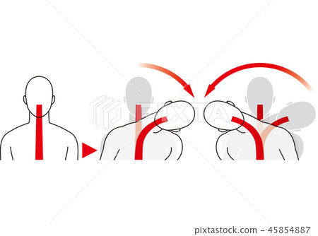 Movement of the neck by impact from the side. Whiplash. 45854887
