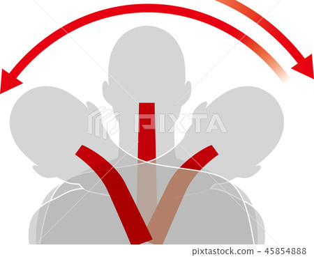 Movement of the neck by impact from the side. Whiplash. Movement of the neck by impact from the side. Whiplash. 45854888