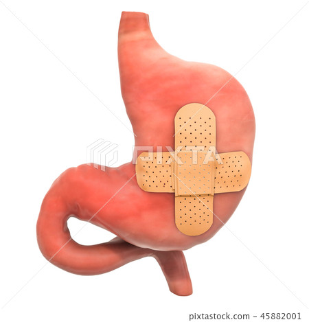 Human stomach with adhesive bandages 45882001