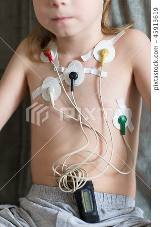 Heart cardiogram using Holter Heart cardiogram using Holter 45913619