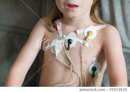 Heart cardiogram using Holter Heart cardiogram using Holter 45913638