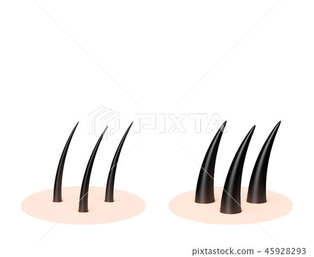 頭髮圖案 頭髮圖案 45928293