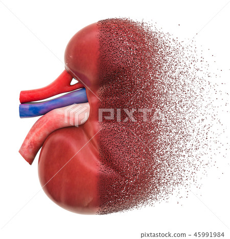 Chronic kidney disease, kidney failure concept 45991984