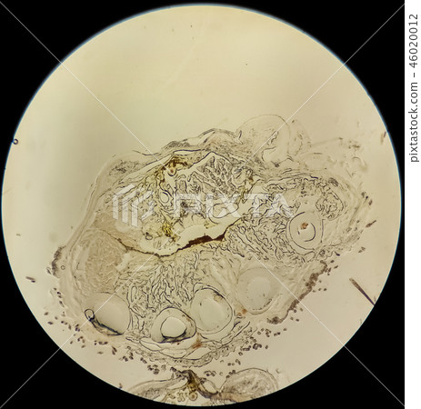 Histological cross-section of a tissue of a mouse Histological cross-section of a tissue of a mouse 46020012