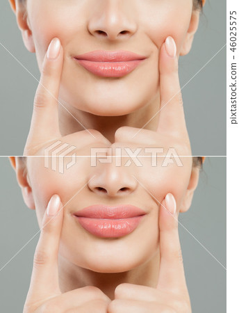 pink lips after filler injection collagen pink lips after filler injection collagen 46025575