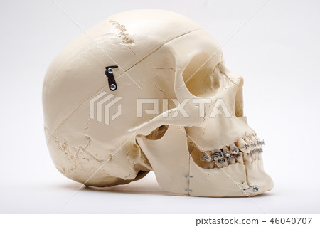 otthodontic braces bracket wire 46040707