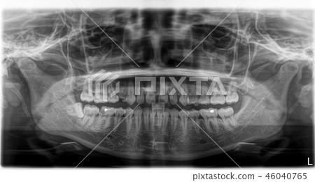 X-ray film Head and mouth X-ray film Head and mouth 46040765