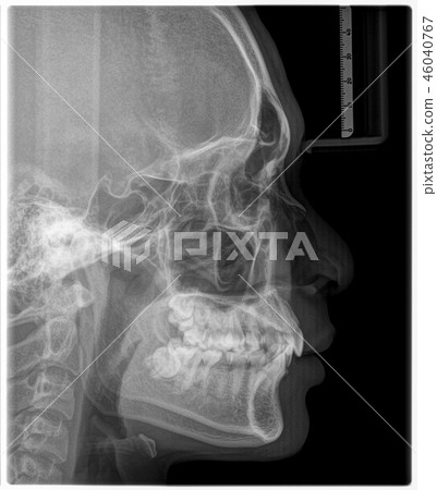 X-ray film Head and mouth 46040767