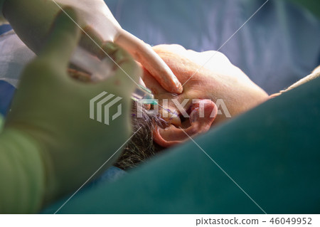 Plastic surgery in operating room. Circular face lift 46049952